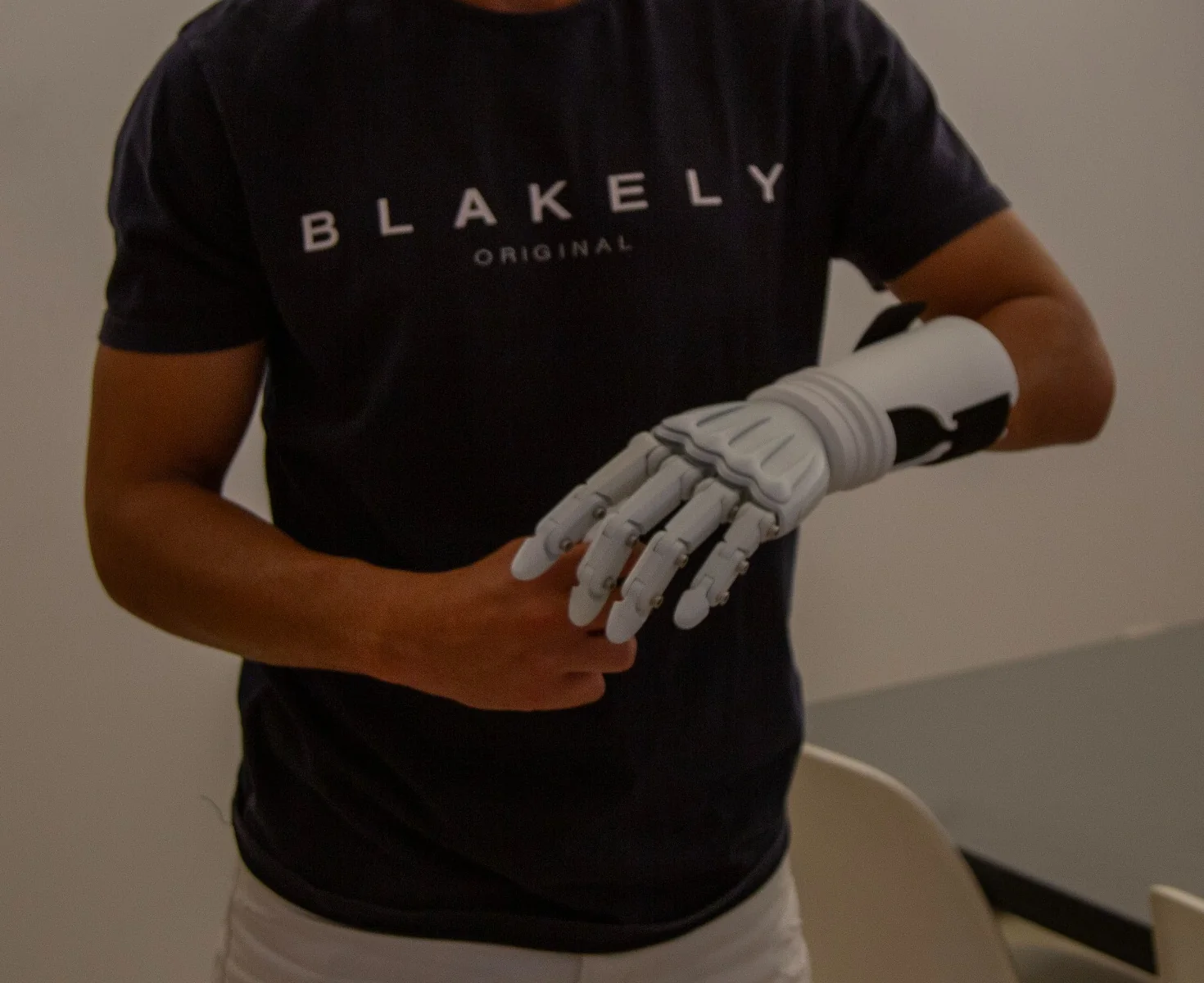 User manually repositioning the prosthesis fingers with the opposite hand