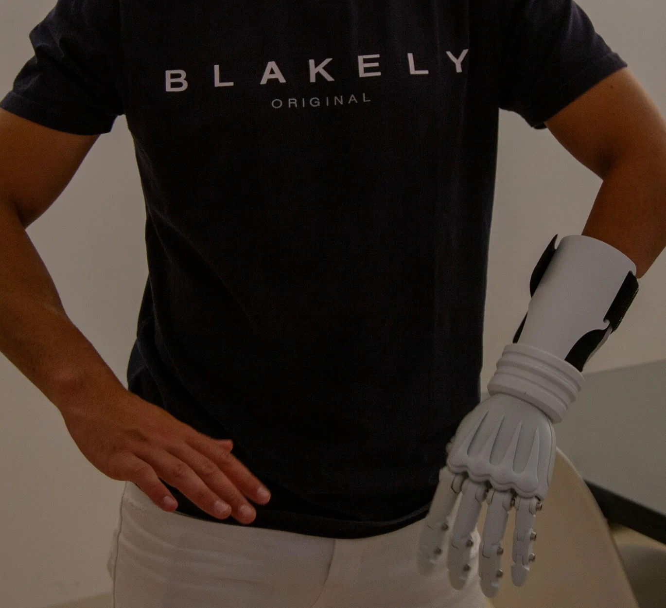 Custom prosthesis worn by the user during a fitting session